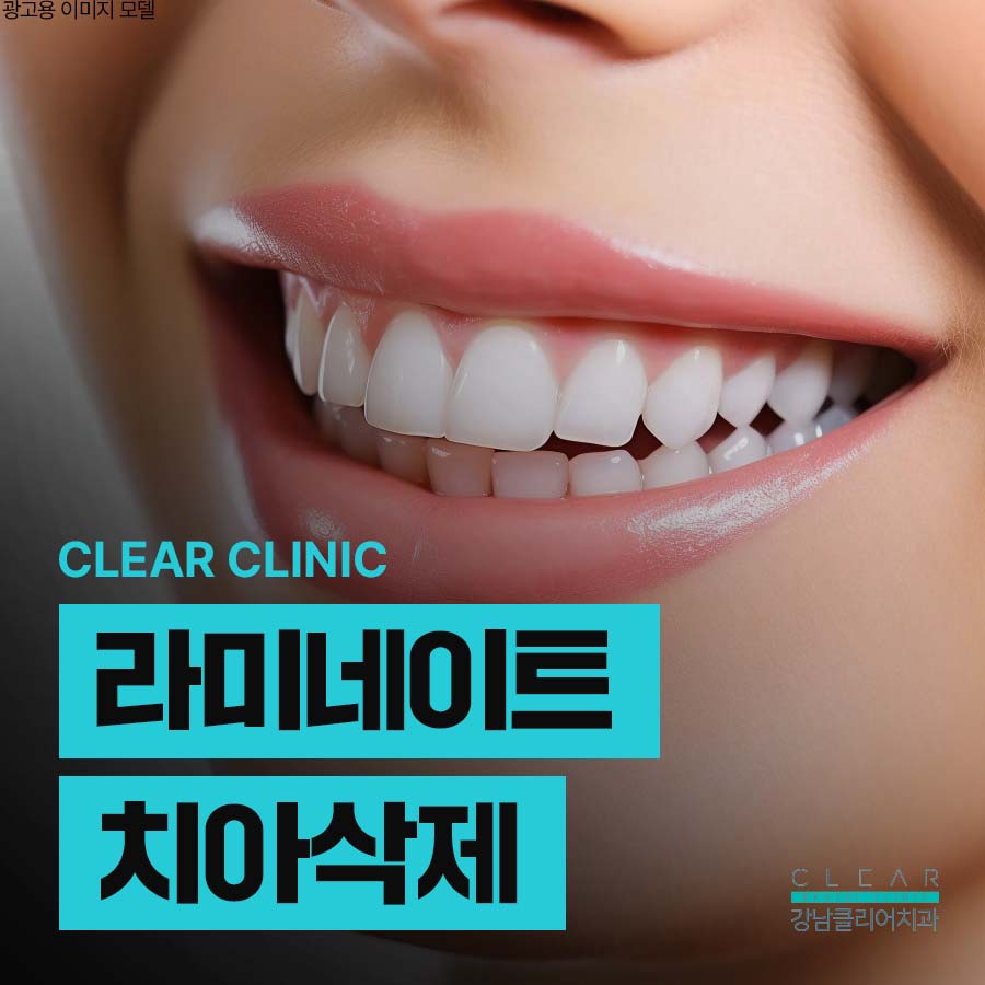 라미네이트 치아삭제 주의할 점 정리 관련 이미지 1
