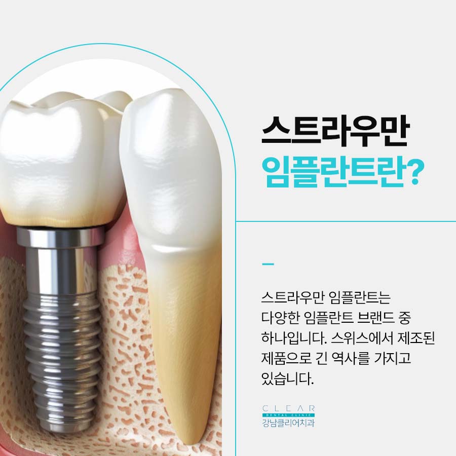 스트라우만 임플란트 특징 정품을 사용해야 되는 이유 관련 이미지 2