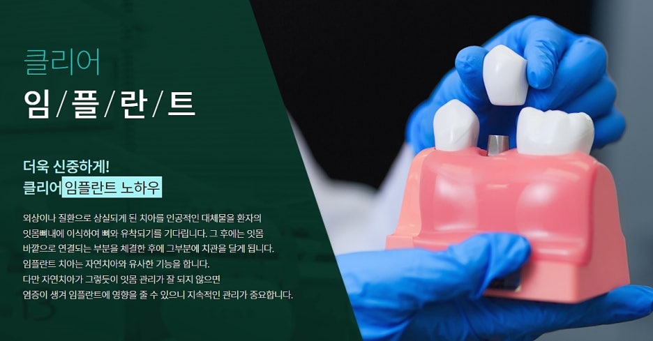 오스템임플란트 클리어치과 만족하려면 관련 이미지 4