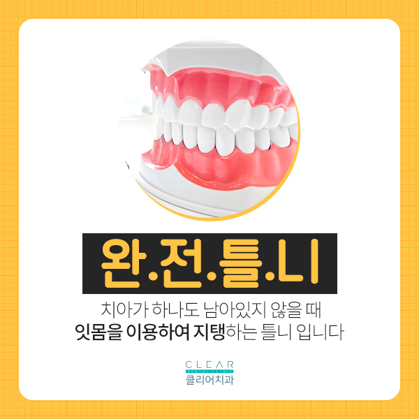 제2의 치아 틀니, 틀니가 무엇인가요? 관련 이미지 3