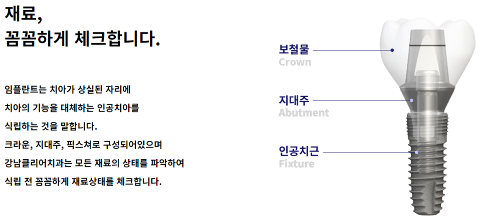 강남역치과유명한곳 찾고 싶다면? 관련 이미지 6