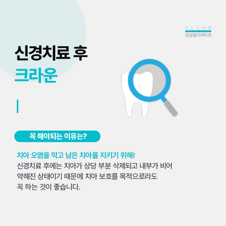 신경치료 후 크라운 꼭 해야되는 이유 관련 이미지 4
