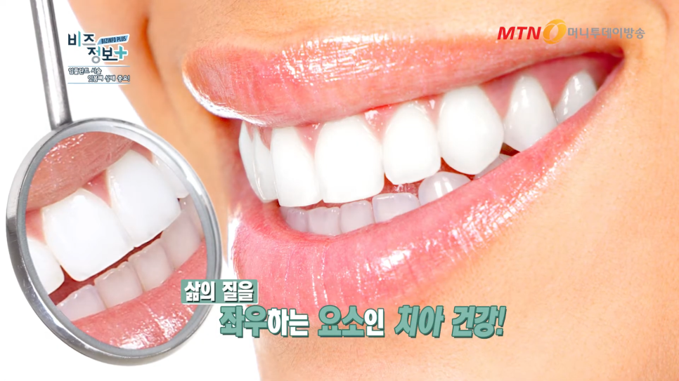 임플란트 주의사항 잇몸뼈의 상태도 봐야 관련 이미지 8