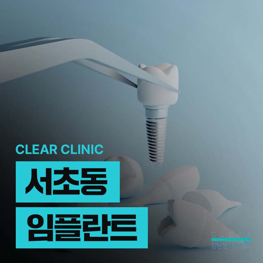 서초동 임플란트 당일 가능한 조건은 관련 이미지 1