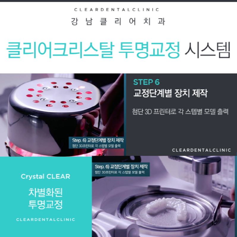 강남역투명교정 자연스러운미소를 가져보세요! 관련 이미지 10