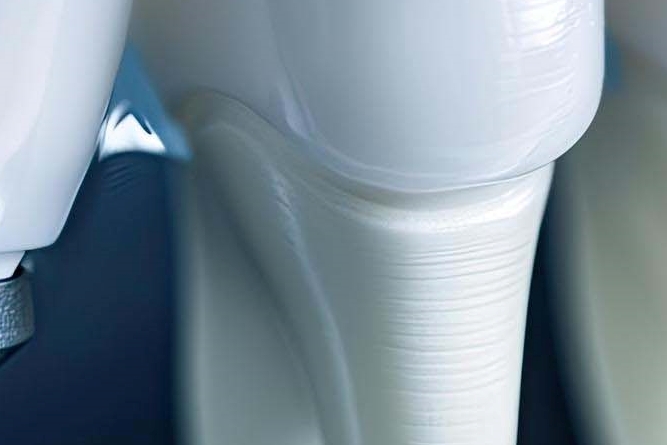 강남클리어치과 상악동에 주목해야해요 관련 이미지 18