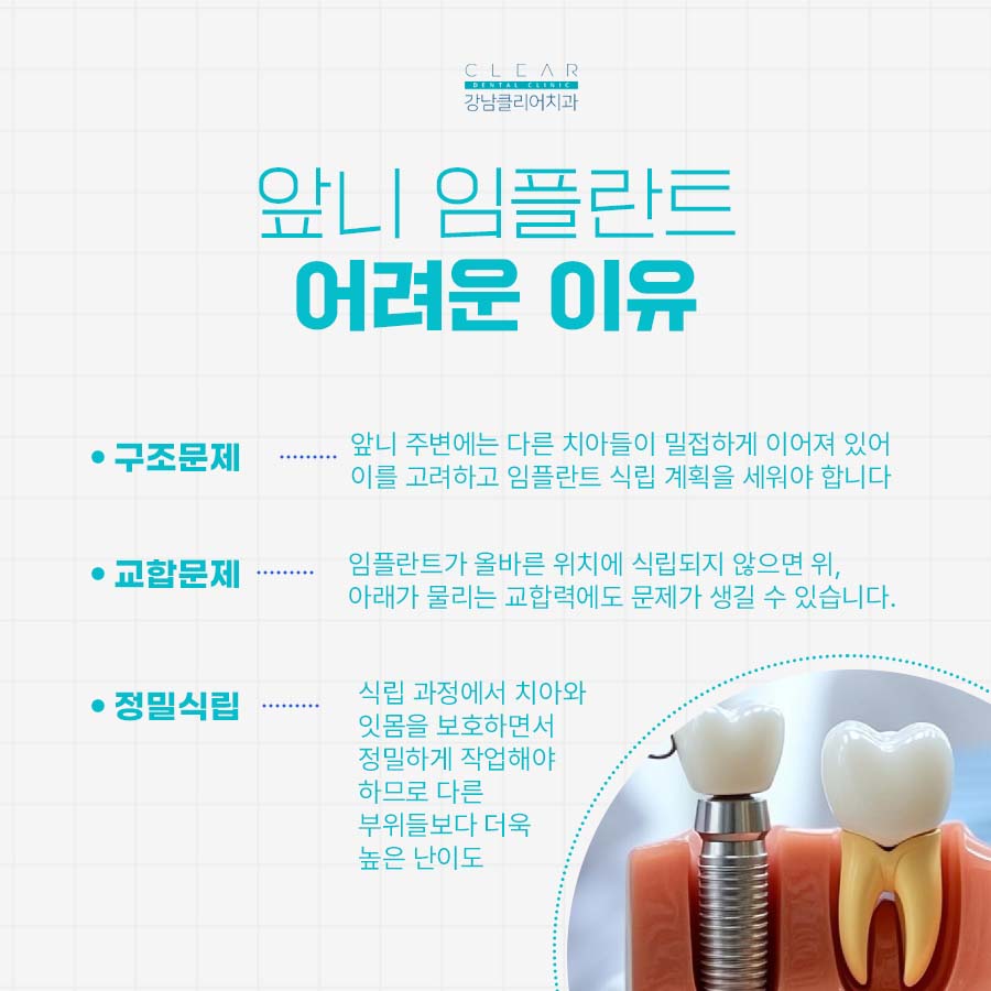 앞니발치 임플란트 난이도가 높은 이유 관련 이미지 4