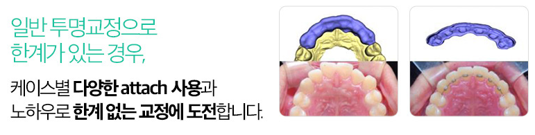 투명교정_이퀄라이징 프로그램 관련 이미지 5