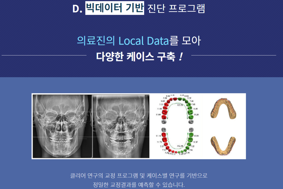 논현동치아교정 틀어진 정도 파악이 우선 관련 이미지 2