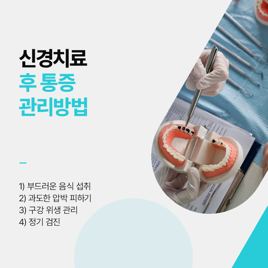 신경치료 후 통증이 생기는 이유 관련 이미지 4