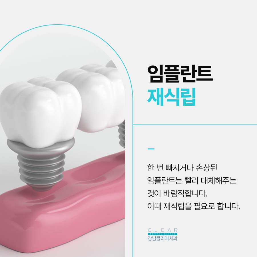임플란트 재식립 재수술 난이도가 높은 이유 관련 이미지 2