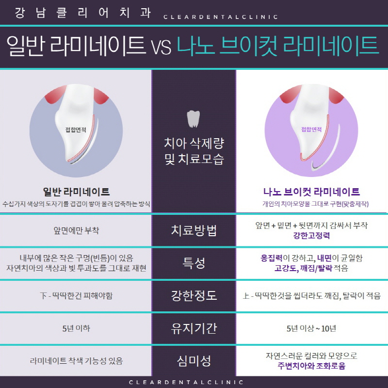 강남라미네이트 앞뒤옆까지 확실하게하자! 관련 이미지 7