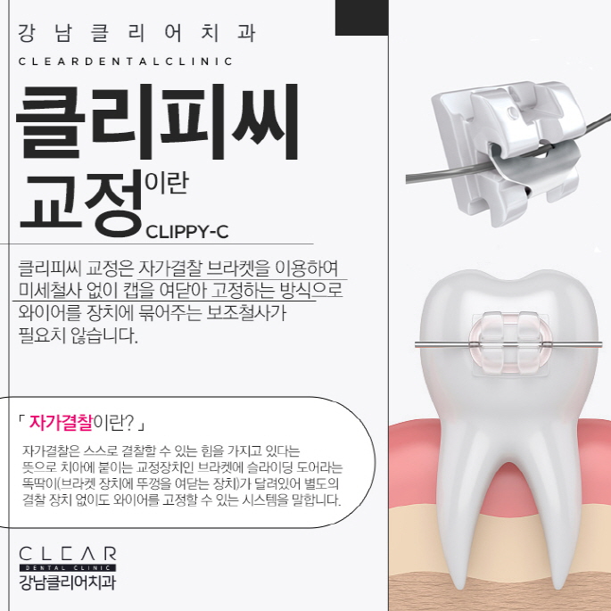 클리피씨교정치과 빠르고 확실한 효과 관련 이미지 2