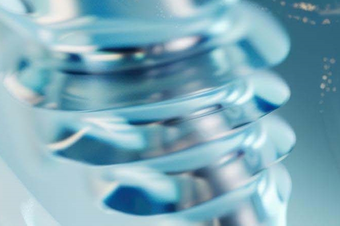 강남클리어치과 상악동 거상술도 가능하니까 관련 이미지 32