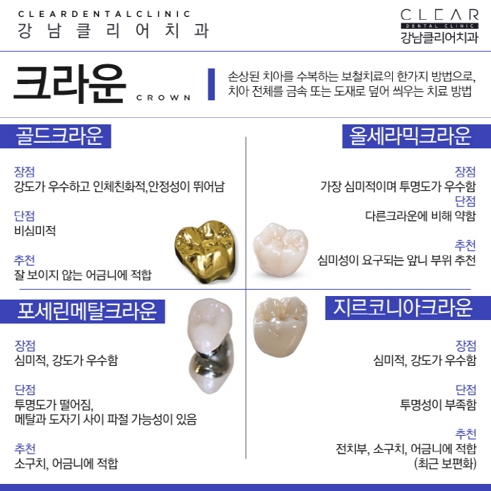 강남역충치 치료 개인별 맞춤형 최적의 솔루션 치료 관련 이미지 11
