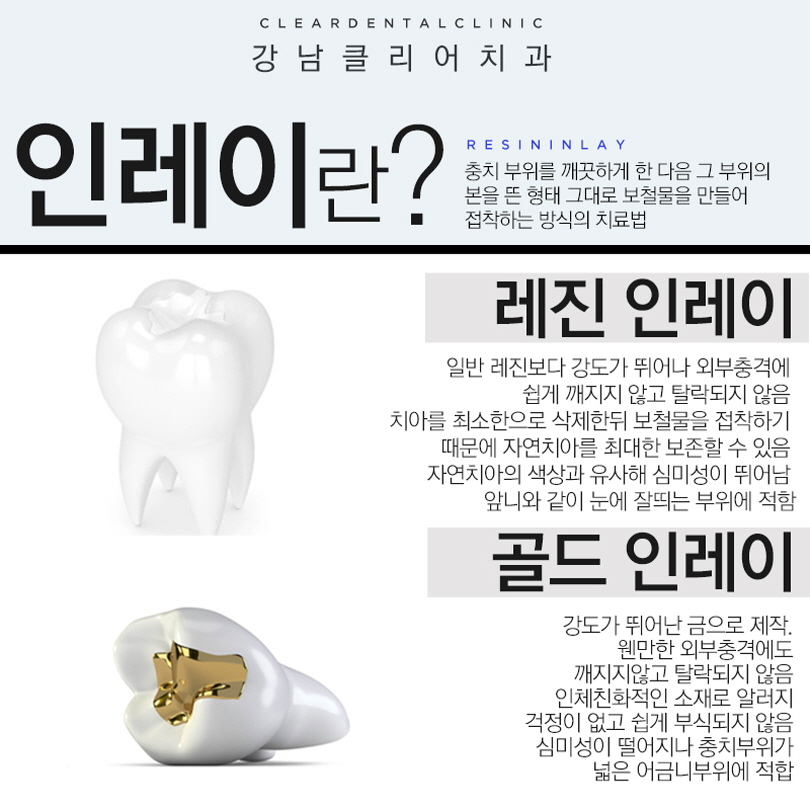 강남역충치치료 걱정보단 빠른 치료가 중요 관련 이미지 5