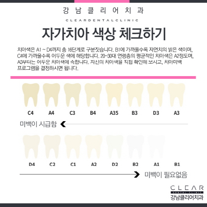 원데이치아미백 치과 치아미백 이벤트로 착한가격까지 관련 이미지 4