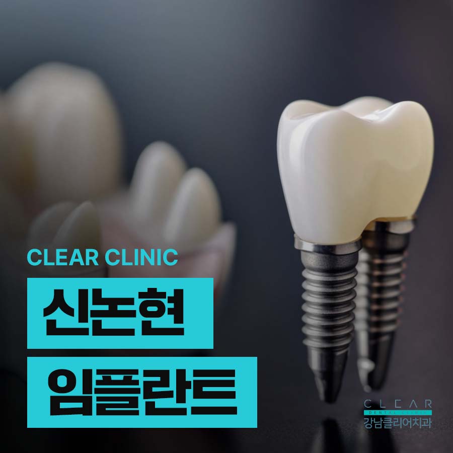 신논현 임플란트 구조 수술과정 총정리 관련 이미지 1