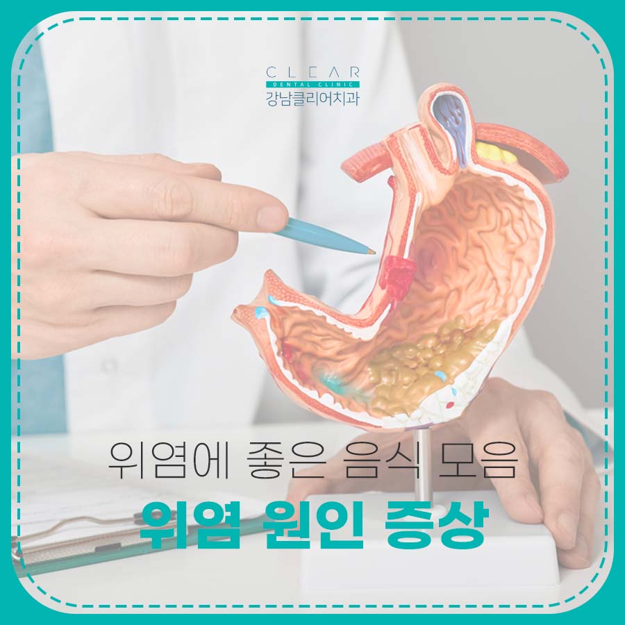 위염 원인 증상 위염에 좋은 음식 모음 관련 이미지 1