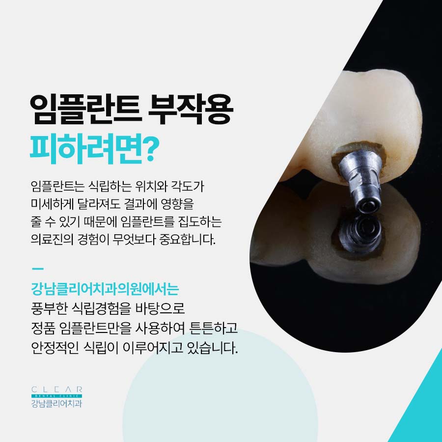 서초역 임플란트 부작용을 피하려면 관련 이미지 3