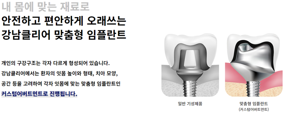 임플란트치과병원 강남 실력좋은 곳 찾는다면 관련 이미지 5