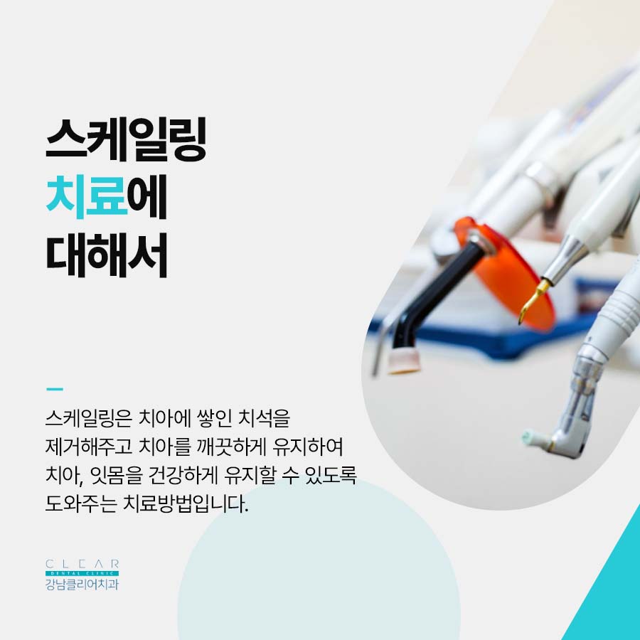 스케일링치과잘하는곳 건강한 잇몸 치아를 생각하면 관련 이미지 2