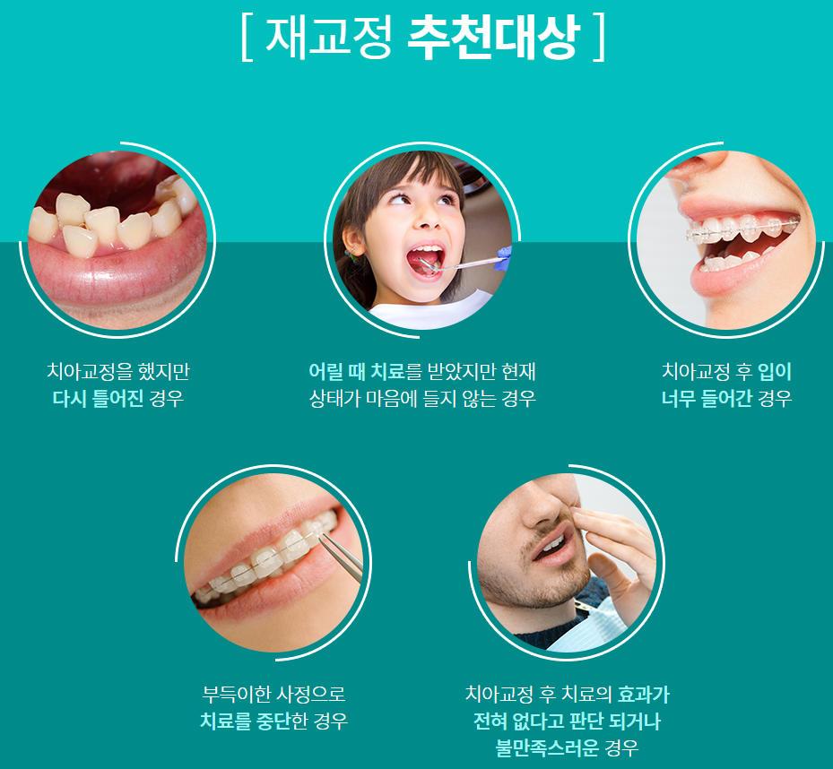 강남치아교정 배열이 신경쓰이는 경우라면? 관련 이미지 8