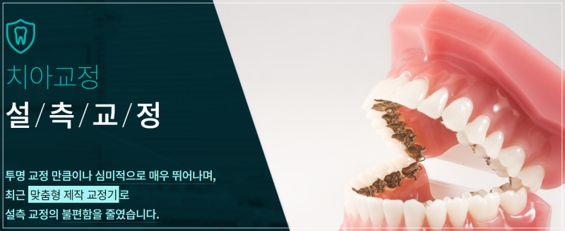 도곡동교정치과 만족스러운 에프터 관련 이미지 3