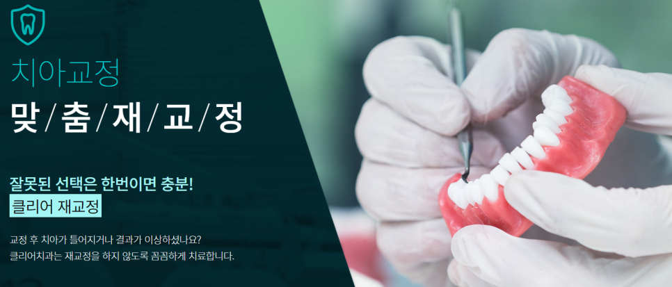 강남치아교정 배열이 신경쓰이는 경우라면? 관련 이미지 6