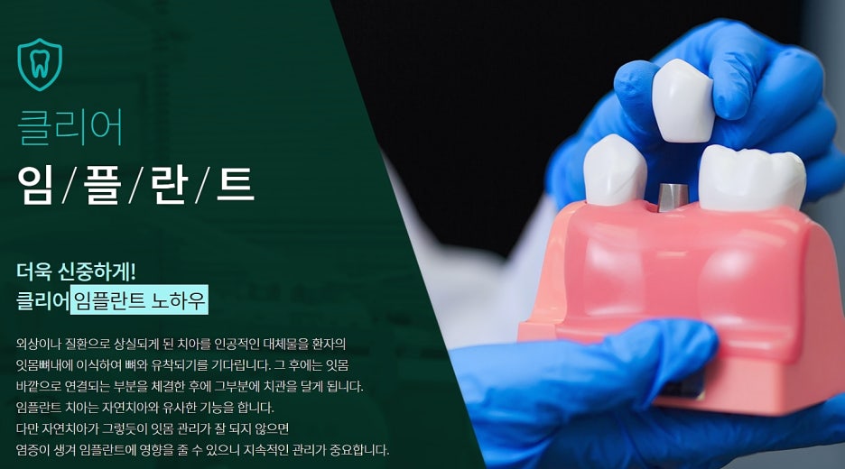 클리어치과 임플란트 치료의 중요성은 관련 이미지 2