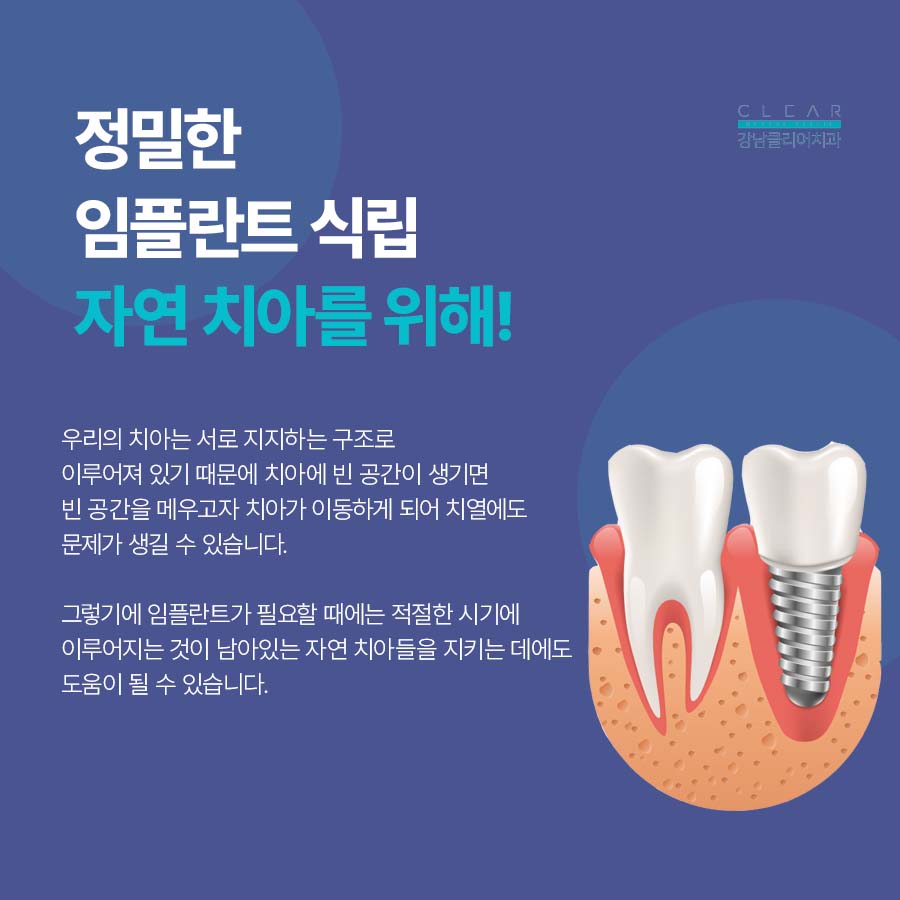 강남역 치과 잘하는곳 충치부터 임플란트까지 관련 이미지 3