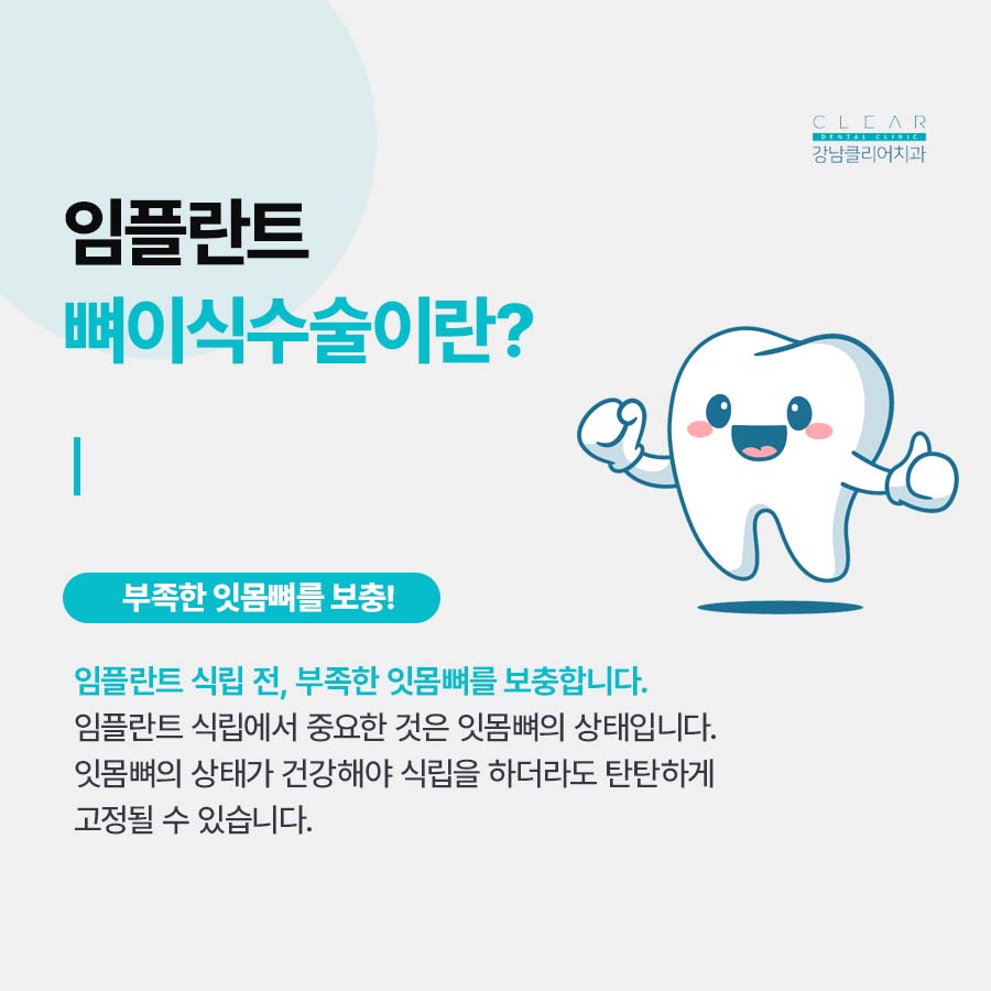 임플란트뼈이식수술 뼈이식 종류 주의사항은? 관련 이미지 3
