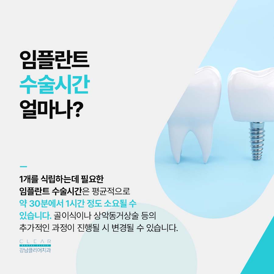 강남역 임플란트 치과 수술과정 및 시간 정리 관련 이미지 4