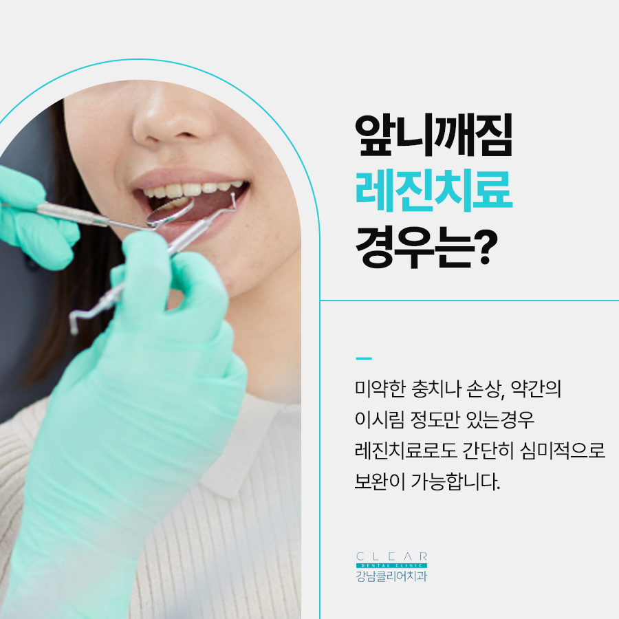 치아레진치료 앞니 깨짐 개선방법으로 관련 이미지 3