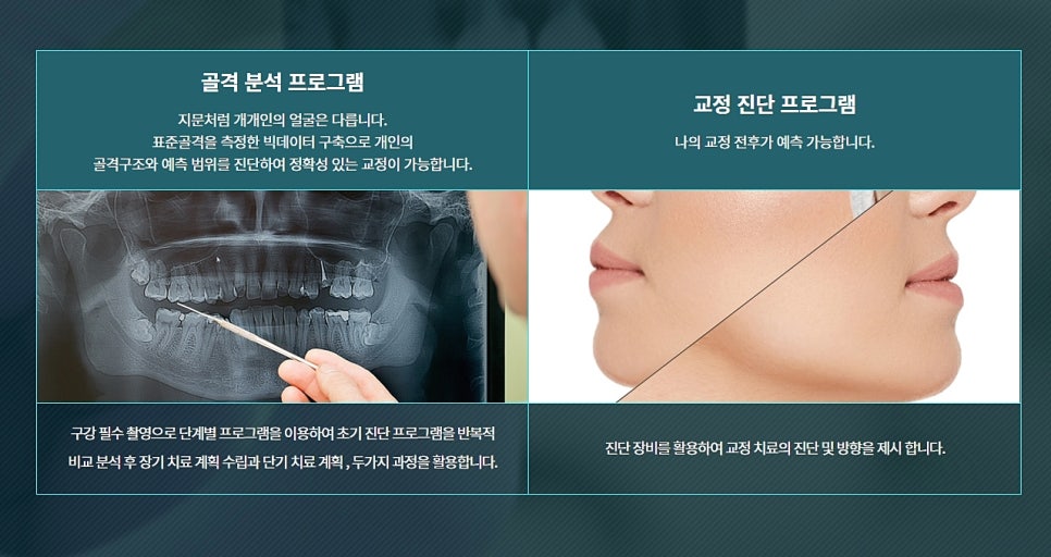 클리피씨 강남클리어 교정 전후도 궁금해 관련 이미지 3
