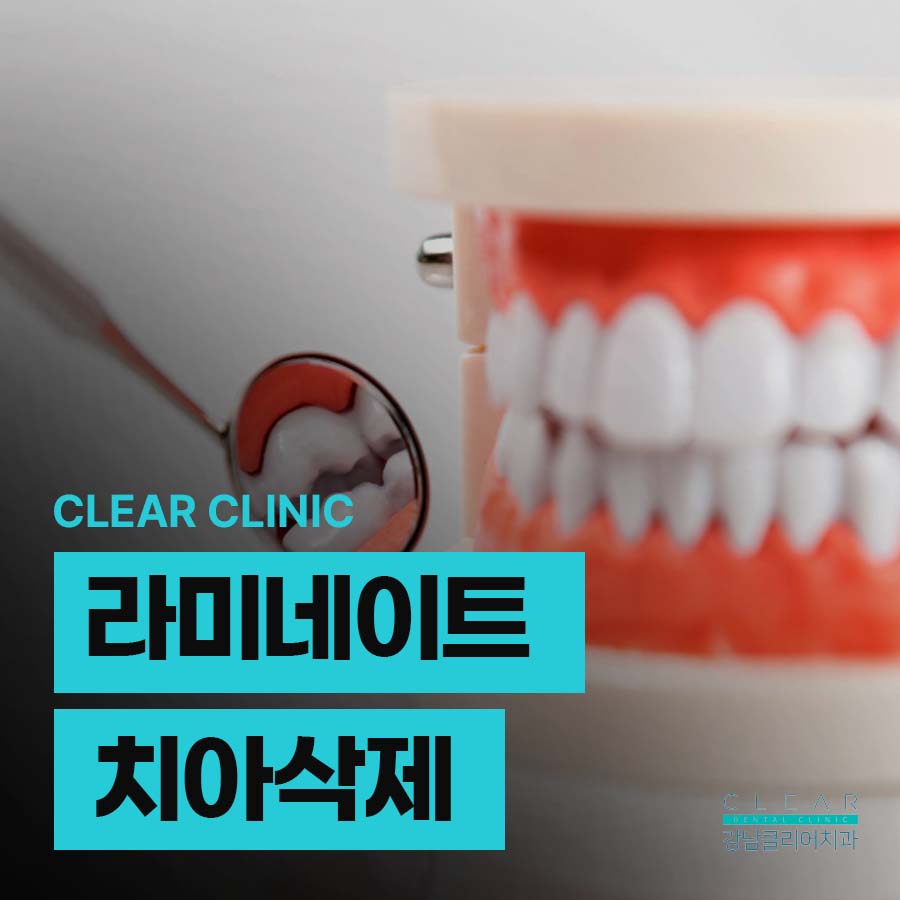 라미네이트 치아삭제 후 주의사항 주목해야 관련 이미지 1
