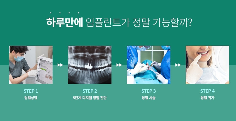 강남역 임플란트 원데이 알아보기 관련 이미지 5