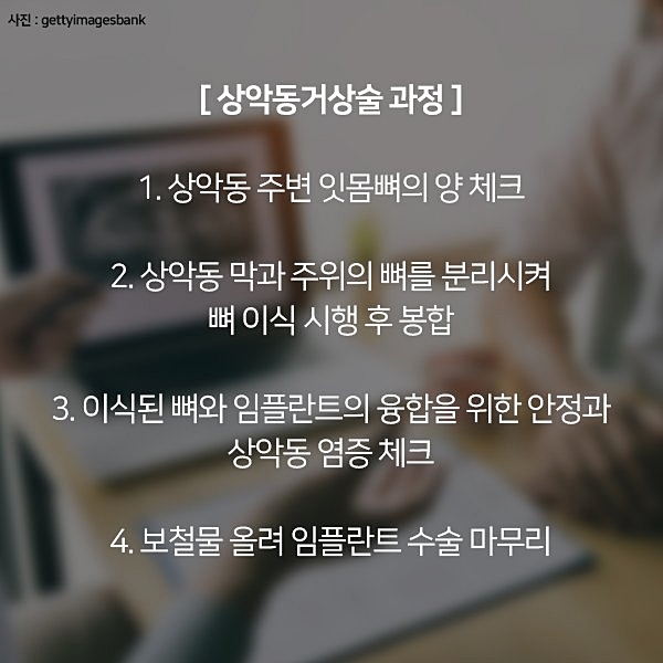 잇몸뼈가 부족해 임플란트 수술 어렵다면? 관련 이미지 11