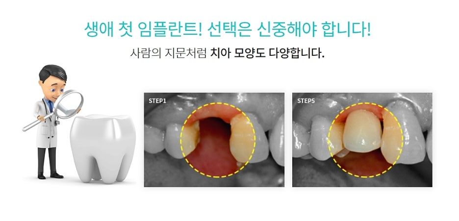 오스템임플란트 클리어치과 만족하려면 관련 이미지 8