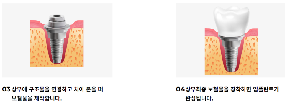 클리어치과 다양한 치아 케어 가능 관련 이미지 3