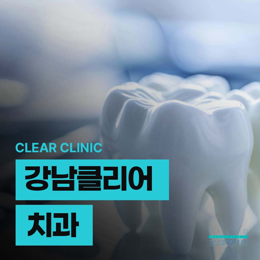 강남클리어치과 라미네이트 적절한 치아삭제가 관건 관련 이미지 1