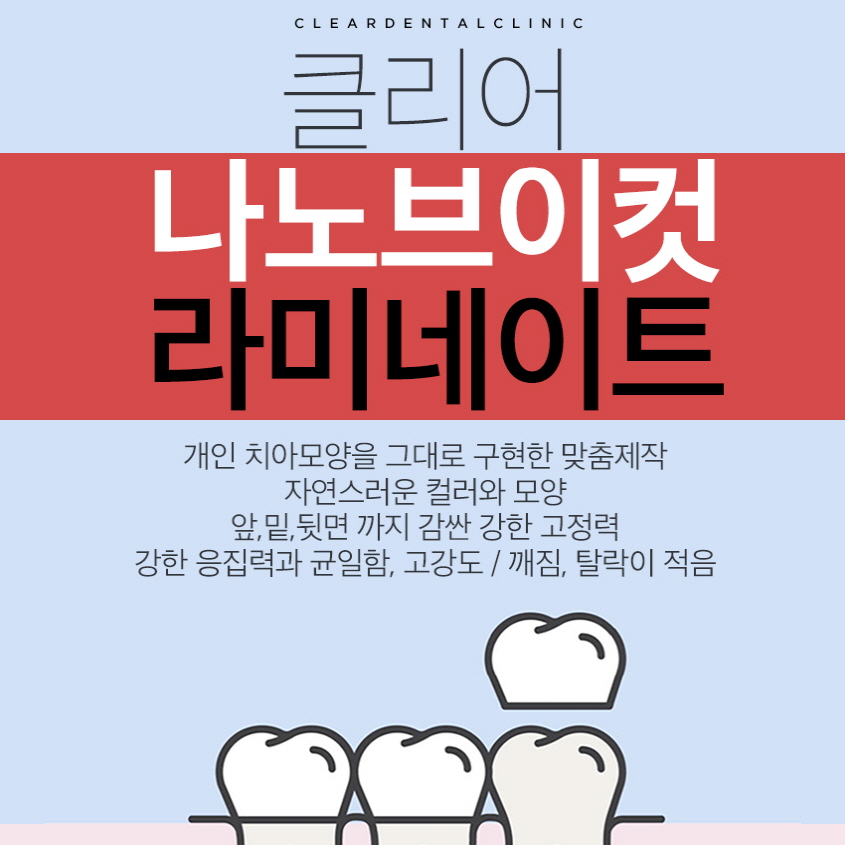 강남역라미네이트 간단히 결정말고 비교하고 따져보세요 관련 이미지 1