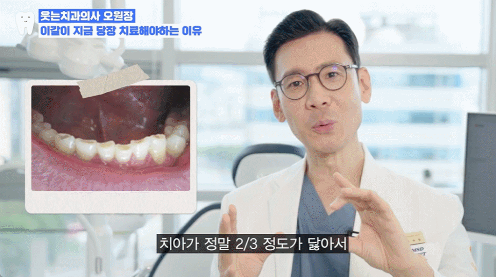 이갈이 이유, 단순한 습관이 아니라 부정교합 때문? 관련 이미지 3