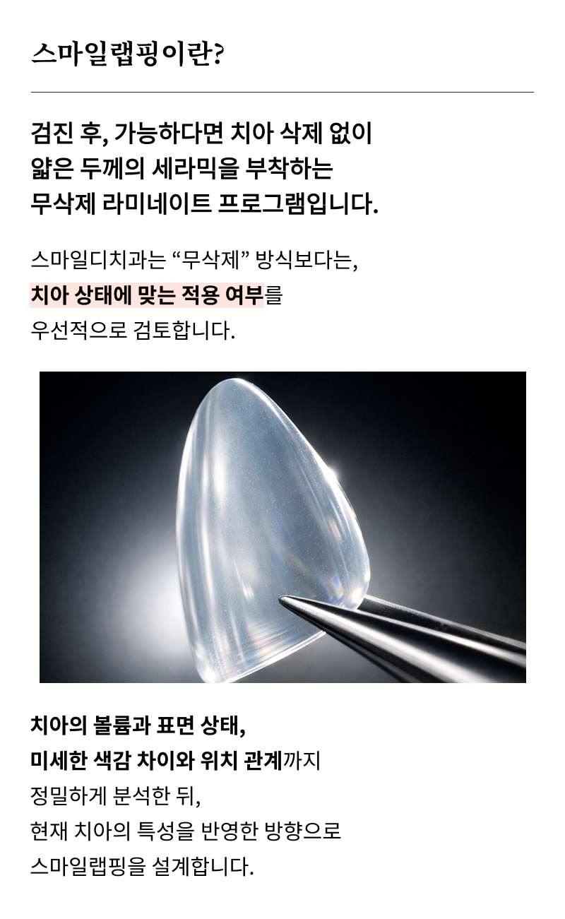 앞니 라미네이트 시술이 고민된다면 관련 이미지 10