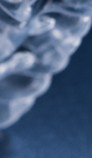 강남교정치과 결정 전 고려할 사항은 관련 이미지 25