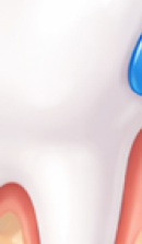 강남 교정치과 과정과 필수 분석 사항들 관련 이미지 38