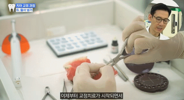 강남교정치과 다니고 관련 이미지 8