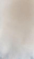 서울교정치과 선택 전 확인해야 할 정밀 진단 기준 관련 이미지 29