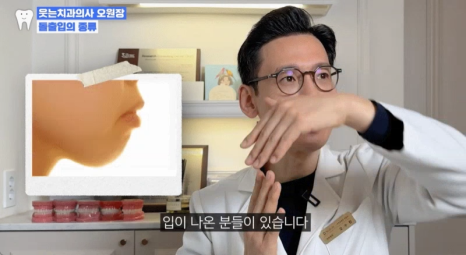 Protruding Mouth Correction Is Also Possible with Invisalign <Written by a Specialist with 18 Years of Experience> image 9