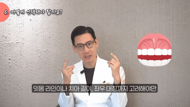 라미네이트와 크라운의 차이, 어떤 기준으로 선택할까요? 관련 이미지 11